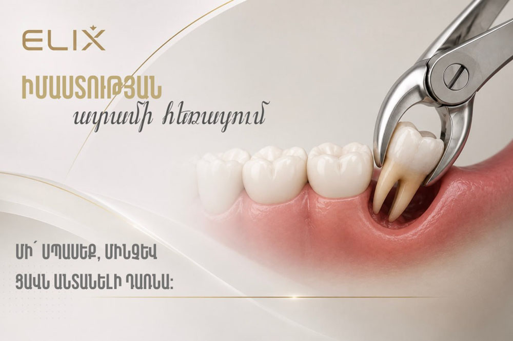 Իմաստության ատամի հեռացում